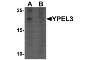 Western blot analysis of YPEL3 in A-20 cell lysate with YPEL3 antibody at 1 ug/mL in (A) the absence and (B) the presence of blocking peptide (YPEL3 抗体  (N-Term))