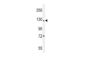 DDX60L Antibody (C-term) (ABIN655540 and ABIN2845051) western blot analysis in NCI- cell line lysates (35 μg/lane). (DDX60L 抗体  (C-Term))