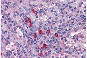 Human Spleen: Formalin-Fixed, Paraffin-Embedded (FFPE) (TLR7 抗体  (AA 465-483))