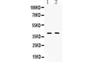 Western blot analysis of Islet 1 expression in PC12 whole cell lysates ( Lane 1) and MCF-7 whole cell lysates ( Lane 2). (ISL1 抗体  (Middle Region))