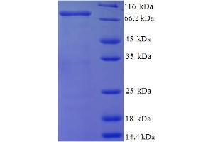 SDS-PAGE (SDS) image for Matrix Metalloproteinase 2 (MMP2) (AA 110-662) protein (His-SUMO Tag) (ABIN5709945)