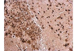 IHC-P Image MEF2A antibody [C2C3], C-term detects MEF2A protein at nucleus on mouse fore brain by immunohistochemical analysis. (MEF2A 抗体  (C-Term))