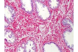 Human Prostate: Formalin-Fixed, Paraffin-Embedded (FFPE) (SLC5A3 抗体)