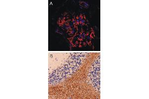 Immunostaining of a glomerolus in in a mouse kidney section (dilution 1 : 200). (SYNPO 抗体  (Isoform 2))