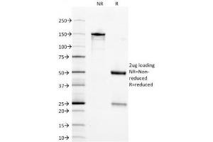 SDS-PAGE Analysis of Purified, BSA-Free NSE Antibody (clone ENO2/1375). (ENO2/NSE 抗体  (AA 416-433))