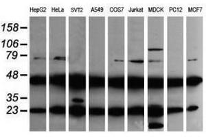 Image no. 2 for anti-Mitogen-Activated Protein Kinase Kinase 1 (MAP2K1) antibody (ABIN1499377) (MEK1 抗体)