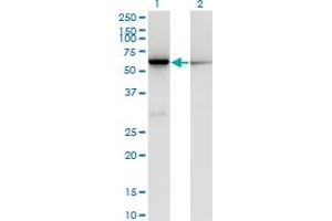 Western Blot analysis of CBS expression in transfected 293T cell line by CBS monoclonal antibody (M02), clone 3D10. (CBS 抗体  (AA 1-100))