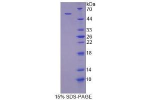 SDS-PAGE analysis of Human TGOLN2 Protein. (TGOLN2 蛋白)
