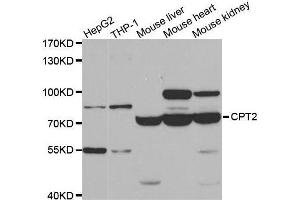 Western blot analysis of extracts of various cell lines, using CPT2 antibody. (CPT2 抗体)
