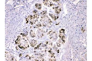 Immunohistochemistry (IHC) image for anti-Fibrinogen gamma Chain (FGG) (AA 133-163), (N-Term) antibody (ABIN4886589)