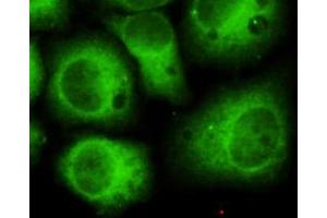 Immunocytochemistry (ICC) image for anti-Cyclin-Dependent Kinase 5 (CDK5) (N-Term) antibody (ABIN6241486)
