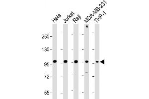 All lanes : Anti-NLRP3 Antibody (N-term) at 1:1000-1:2000 dilution Lane 1: Hela whole cell lysate Lane 2: Jurkat whole cell lysate Lane 3: Raji whole cell lysate Lane 4: MDA-MB-231 whole cell lysate Lane 5: THP-1 whole cell lysate Lysates/proteins at 20 μg per lane. (NLRP3 抗体  (N-Term))