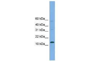 WB Suggested Anti-CRABP2 Antibody Titration:  0. (CRABP2 抗体  (Middle Region))