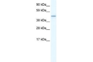 WB Suggested Anti-TMEM108 Antibody Titration:  1. (TMEM108 抗体  (Middle Region))