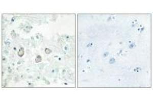 Immunohistochemistry analysis of paraffin-embedded human brain tissue using DOK7 antibody. (DOK7 抗体  (N-Term))