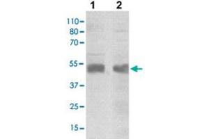 The tissue/cell lysates derived from mouse brain (lane 1), HeLa (lane 2) were immuno-probed by SOCS4 polyclonal antibody  at 1 : 500. (SOCS4 抗体  (C-Term))