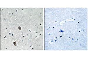 Immunohistochemistry analysis of paraffin-embedded human brain tissue using OXR1 antibody. (OXR1 抗体  (Internal Region))