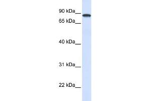 WB Suggested Anti-DDX1 Antibody Titration:  0. (DDX1 抗体  (Middle Region))