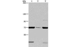 Western Blot analysis of LoVo cell, Human testis tissue and A549 cell using FAAH Polyclonal Antibody at dilution of 1:400 (FAAH 抗体)
