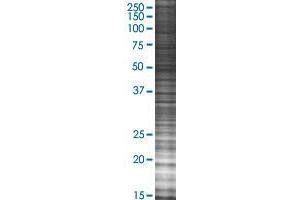 DDIT4L 293T Cell Transient Overexpression Lysate(Denatured)