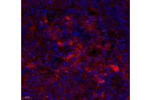 Immunofluorescence of paraffin embedded human tonsil using MS4A2 (ABIN7074594) at dilution of 1: 400 (400x lens) (MS4A2 抗体)