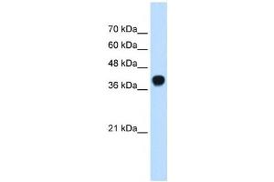 SQLE antibody used at 0. (SQLE 抗体  (C-Term))