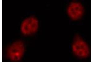 ABIN6269286 staining HepG2 by IF/ICC. (Ataxin 1 抗体  (C-Term))