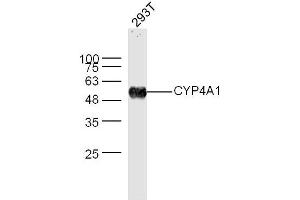 293T lysates probed with CYP4A1 Polyclonal Antibody, Unconjugated  at 1:300 dilution and 4˚C overnight incubation. (CYP4A11 抗体  (AA 351-450))