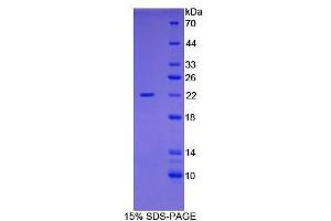 SDS-PAGE analysis of Human Cofilin 1, Non Muscle Protein. (Cofilin 蛋白)