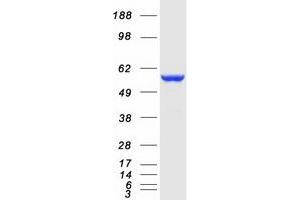 Western Blotting (WB) image for Cytochrome B5 Reductase 4 (CYB5R4) protein (Myc-DYKDDDDK Tag) (ABIN2712718)
