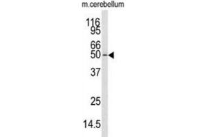 Western Blotting (WB) image for anti-Calcium/calmodulin-Dependent Protein Kinase Kinase 1, alpha (CAMKK1) antibody (ABIN3003479) (CAMKK1 抗体)