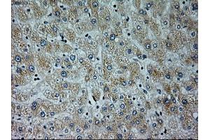 Immunohistochemical staining of paraffin-embedded liver tissue using anti-NEUROG1mouse monoclonal antibody. (Neurogenin 1 抗体)