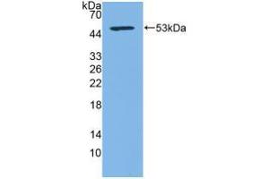 Western blot analysis of recombinant Human CD83. (CD83 抗体  (AA 24-205))
