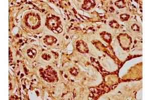 IHC image of nacHU diluted at 1:20 and staining in paraffin-embedded human breast cancer performed on a Leica BondTM system. (HIST1H4A 抗体  (AA 10-22))