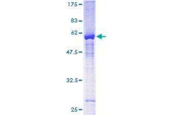 ZNF277 Protein (AA 1-278) (GST tag)