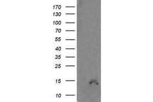 Image no. 3 for anti-Cyclin-Dependent Kinase Inhibitor 2B (p15, Inhibits CDK4) (CDKN2B) antibody (ABIN1497447)