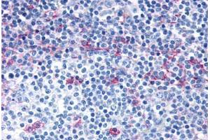 Anti-CCR7 antibody  ABIN1048400 IHC staining of human lymph node. (CCR7 抗体  (C-Term))