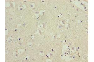 Immunohistochemistry of paraffin-embedded human brain tissue using ABIN7148625 at dilution of 1:100 (CRHR1 抗体  (AA 24-121))