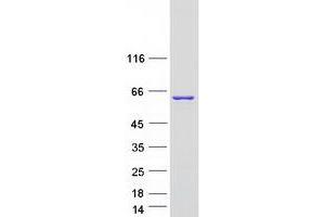 Western Blotting (WB) image for Non-POU Domain Containing, Octamer-Binding (NONO) (Transcript Variant 3) protein (Myc-DYKDDDDK Tag) (ABIN2727465)