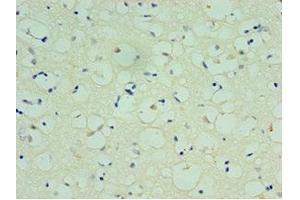Immunohistochemistry of paraffin-embedded human brain tissue using ABIN7170477 at dilution of 1:100 (SPAG16 抗体  (AA 1-183))