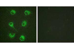 Peptide - +Immunofluorescence analysis of HuvEc cells, using CrkL (Ab-207) antibody (#B0067). (CrkL 抗体  (Tyr207))