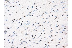 Immunohistochemical staining of paraffin-embedded Ovary tissue using anti-AKR1A1mouse monoclonal antibody. (AKR1A1 抗体)