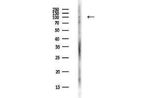 anti-Zinc Finger Protein 574 (ZNF574) antibody
