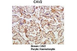 Sample Type :  Human placental tissue   Primary Antibody Dilution :   1:50  Secondary Antibody :  Goat anti rabbit-HRP   Secondary Antibody Dilution :   1:10,000  Color/Signal Descriptions :  Brown: CAV2 Purple: Haemotoxylin  Gene Name :  CAV2  Submitted by :  Dr. (Caveolin 2 抗体  (N-Term))