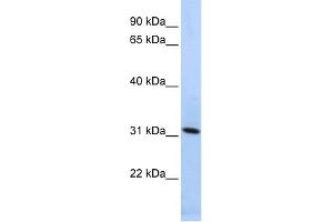 WB Suggested Anti-SYNGR4 Antibody Titration:  0. (SYNGR4 抗体  (N-Term))