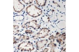 Immunohistochemical analysis of DMGDH staining in human kidney formalin fixed paraffin embedded tissue section. (DMGDH 抗体  (C-Term))
