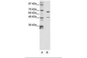 Image no. 1 for anti-Zinc Finger Protein 597 (ZNF597) (AA 48-97) antibody (ABIN6736181) (ZNF597 抗体  (AA 48-97))