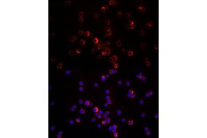 Immunofluorescence analysis of THP-1 cells using CXCL12 antibody (ABIN6130152, ABIN6139271, ABIN6139272 and ABIN6217180) at dilution of 1:200. (CXCL12 抗体  (AA 22-89))