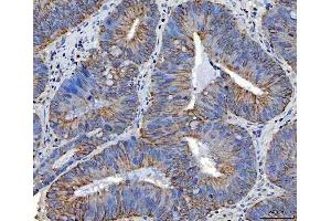 IHC analysis of TRAM1L1 using anti-TRAM1L1 antibody (ABIN7602939).