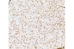 anti-Dpy-30 Homolog (DPY30) (AA 1-50) antibody